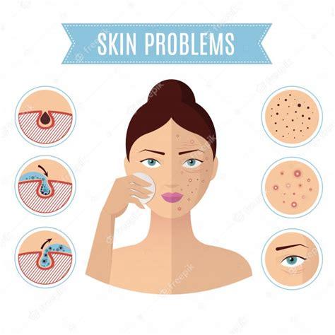 Solución de problemas de la piel. tratamiento del acné y: Dibujar Fácil, dibujos de Poros De La Piel, como dibujar Poros De La Piel para colorear e imprimir